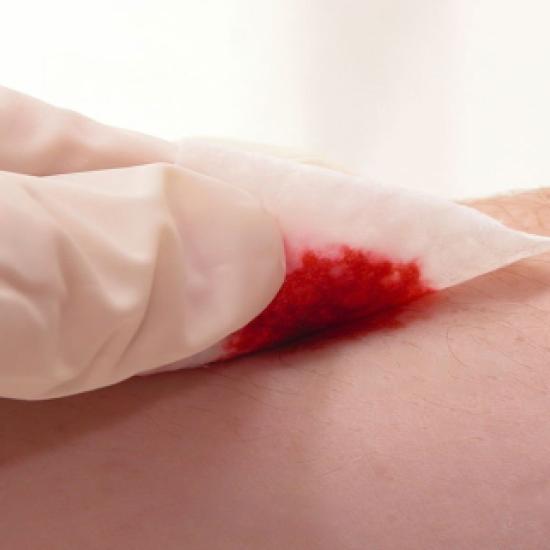 Comment arrêter un saignement sur une plaie ? 