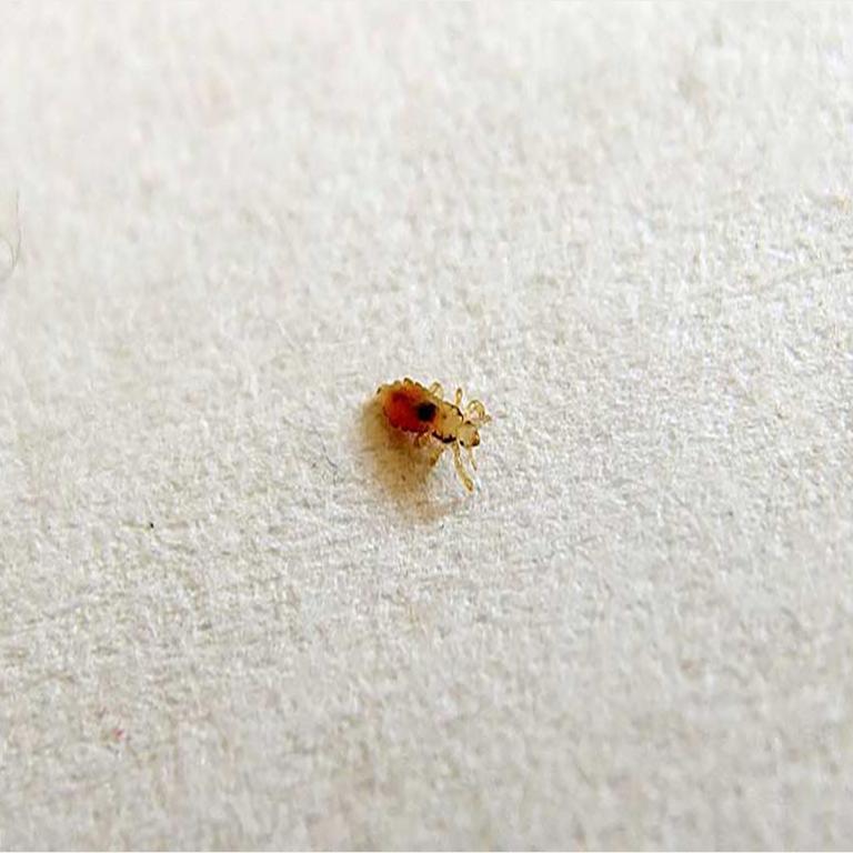 Poux : Comment s'en débarrasser ?