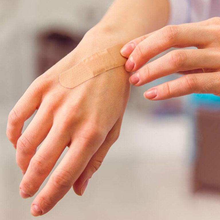 Les assortiments de pansements pour prendre soins d'une plaie.