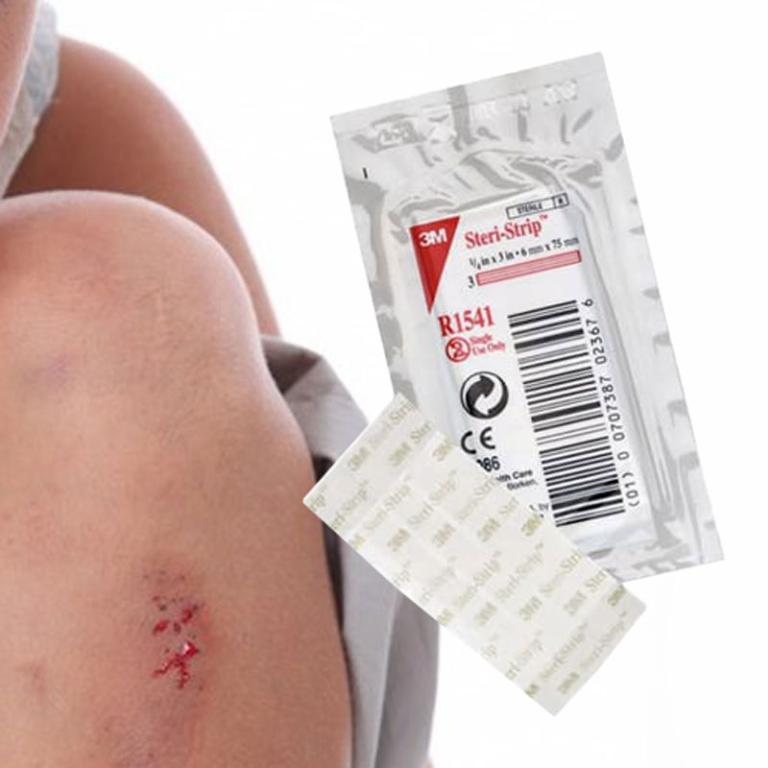 Comment poser un steri-strip ?