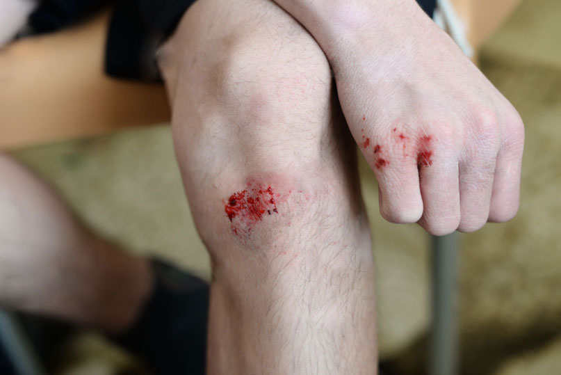 Homme avec un saignement sur le genou